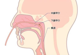 経鼻挿入